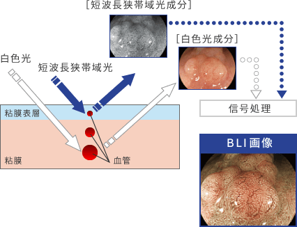 血管や表面構造などを的確に映し出します