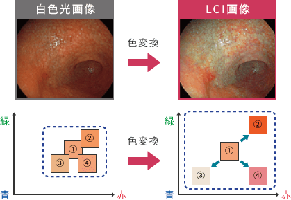 粘膜の微妙な色の違いを強調し炎症の診断に役立てます